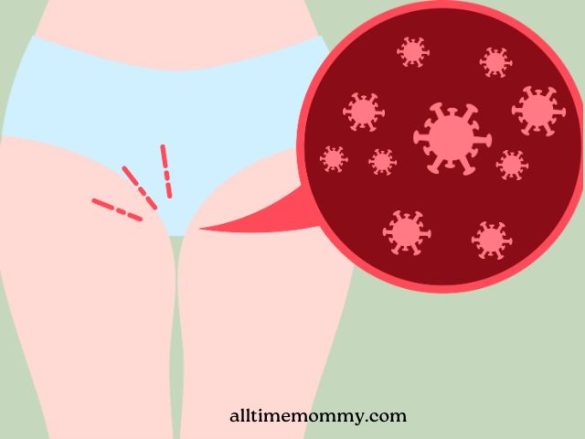 at home remedies for uti