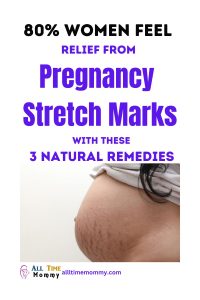 how to prevent pregnancy stretch marks