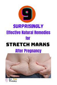 how to get rid of stretch marks after pregnancy