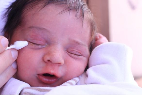 newborn problems