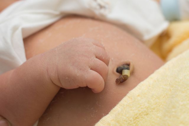 newborn umbilical cord care